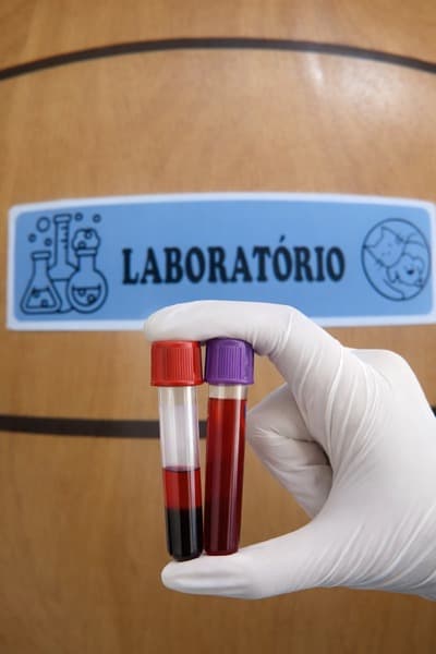 Quando Fazer Hemograma no Gato: guia completo para tutores